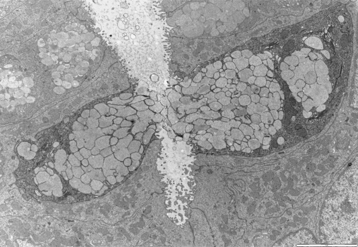 צילום במיקרוסקופ אלקטרונים חודר: שני תאי גביע המפרישים את תוכנם לתוך חלל המעי